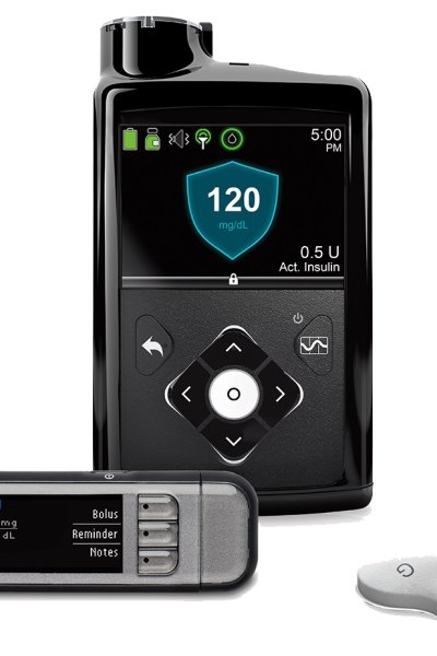The MiniMed 670G insulin pump as seen above. The Food and Drug Administration has issued a recall of Medtronic's 600 series pumps, including the 630 and 670, due to a broken retainer ring that has caused at least one death.