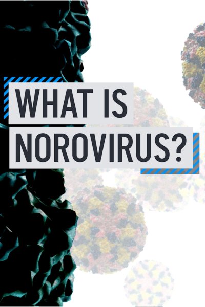 What is Norovirus